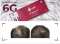CAPIXY ANTI HAIR LOSS 7 VIAL X 10ML
